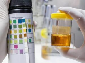 drug abuse test kit